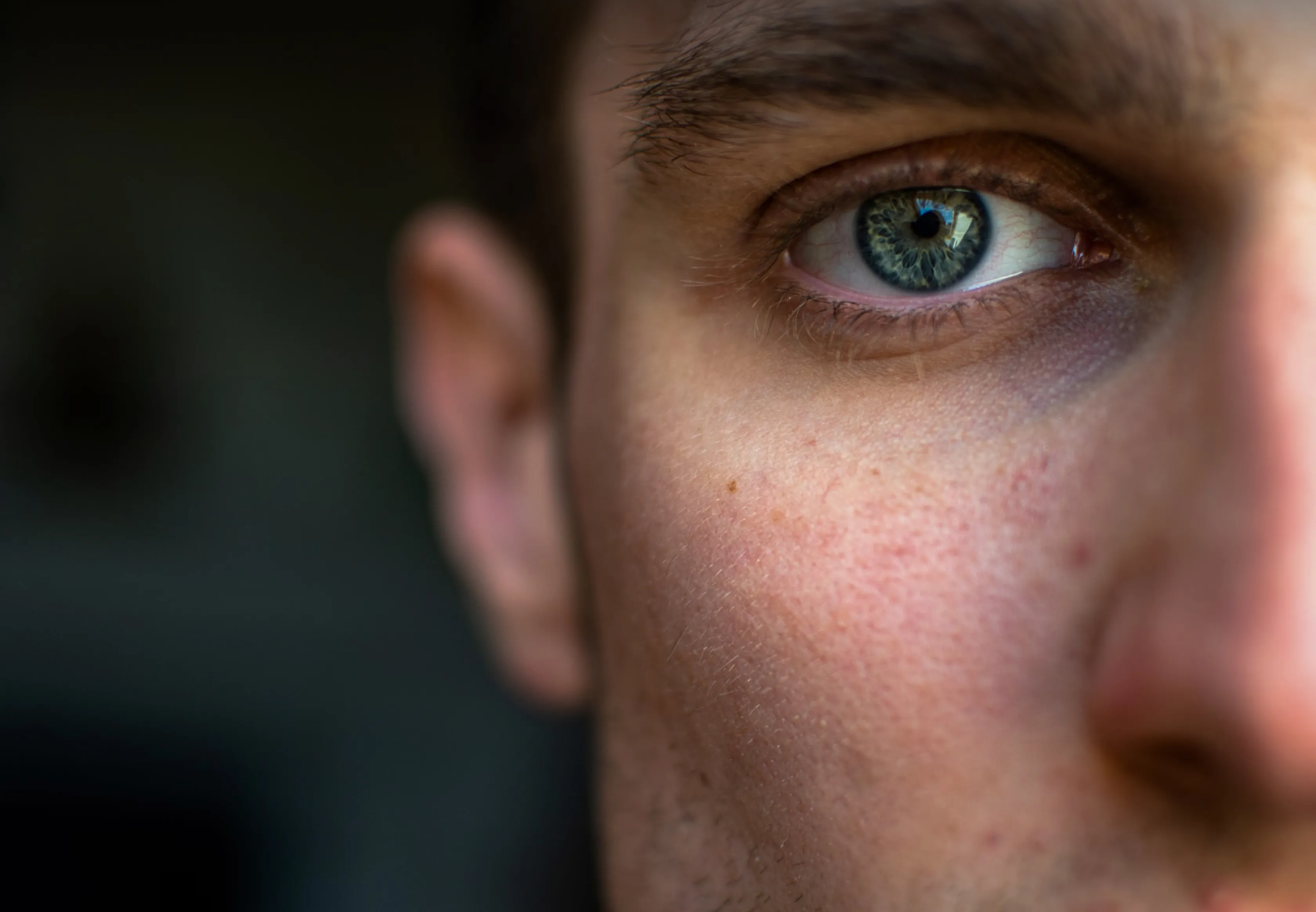 Close-up of an eye from the VisionPros brand imagery